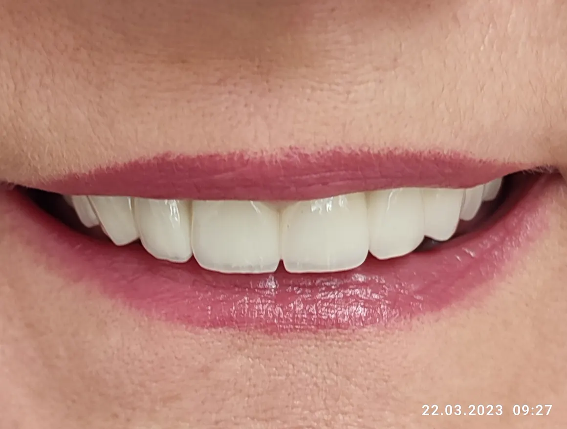 Stomatološka Ordinacija "Dr.Emina Golić" — fotografija 4